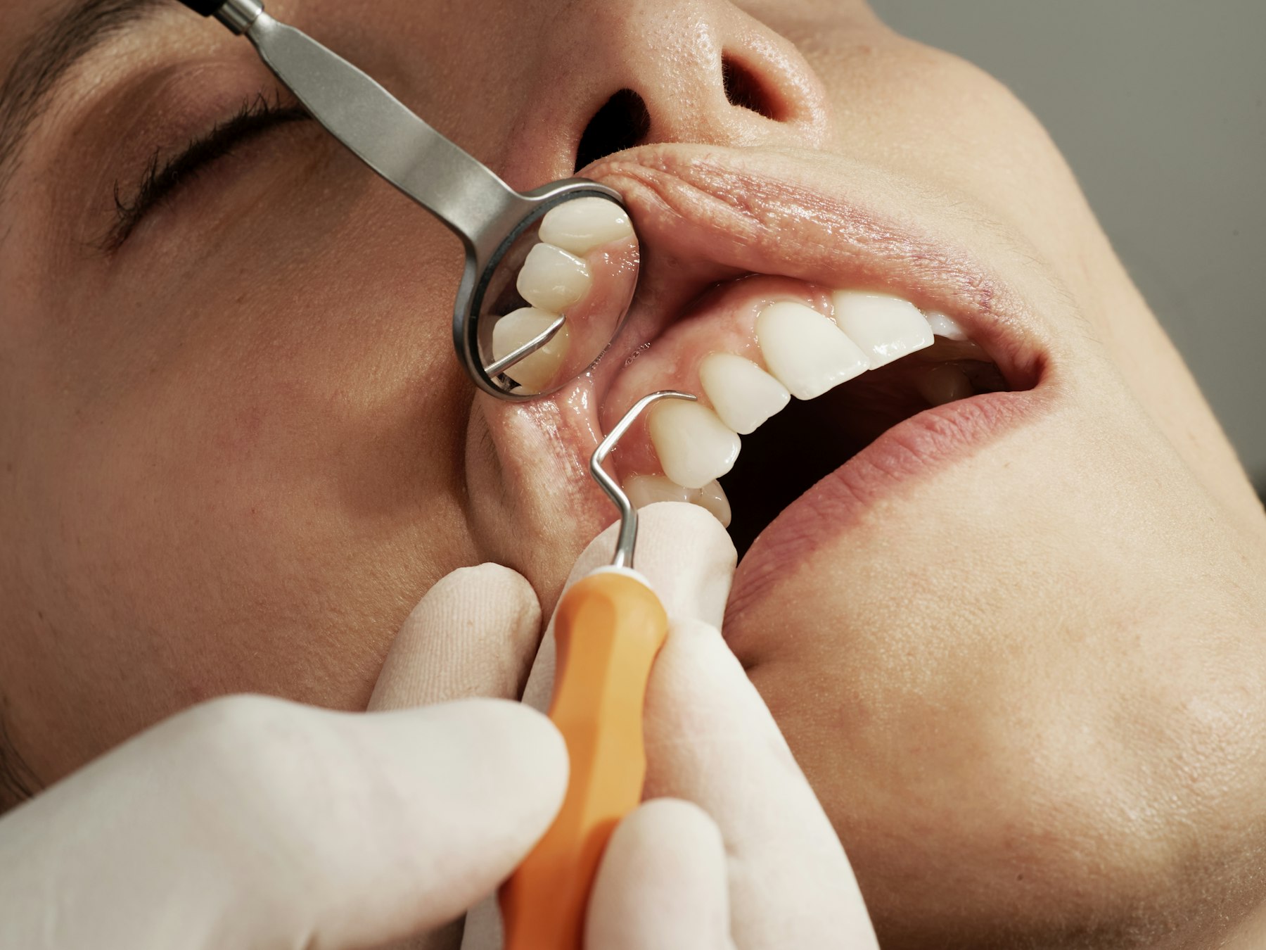 Implants & Restorative